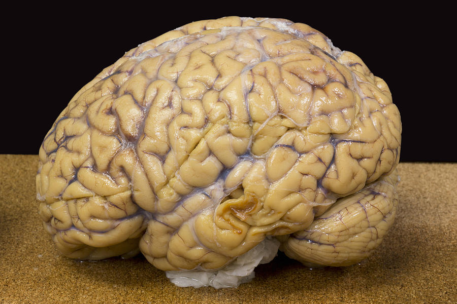 Left Human Cerebrum And Cerebellum Photograph by Science Stock Photography