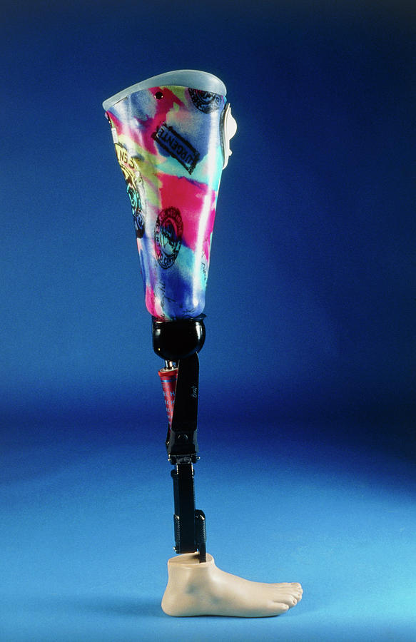 Leg Prosthesis With Reflex Foot (side View) Photograph by Medical Photo ...