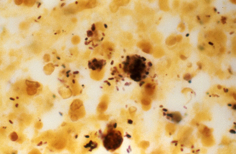 Legionella Pneumophila Bacteria, Lm Photograph by Science Source