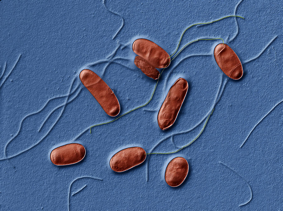 Legionella Pneumophila, Tem Photograph by Eye of Science