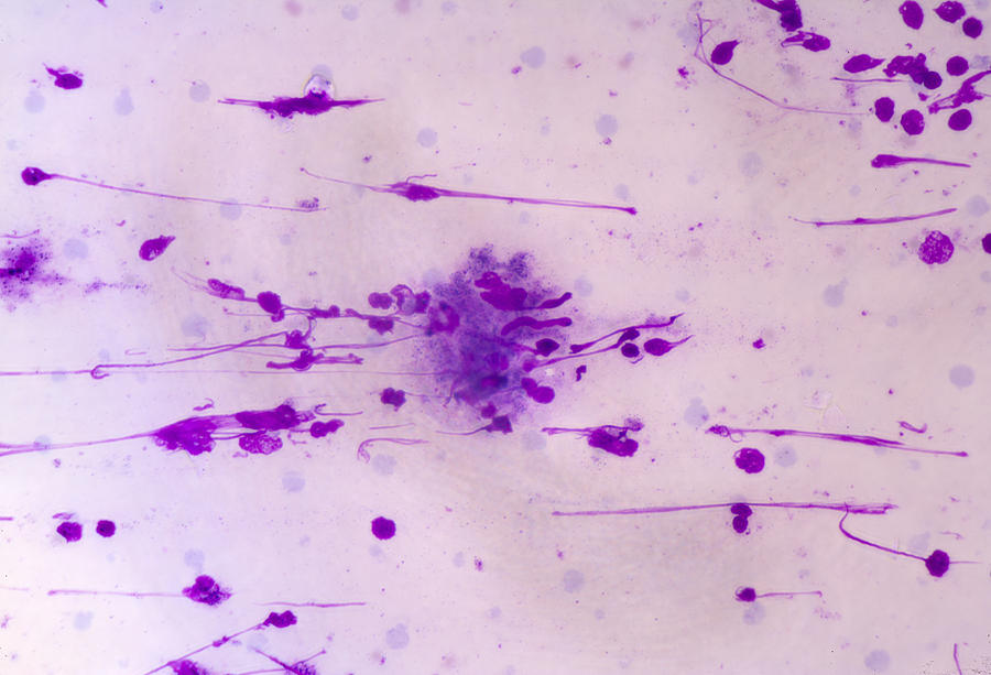 Horizontal Photograph - Leishmania Donovani Protozoans, Lm by Science Stock Photography