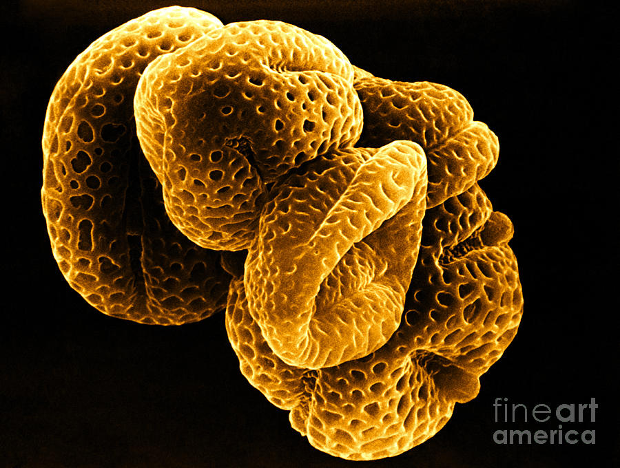 Flowers Still Life Photograph - SEM of Lemon Tree Pollen by Biophoto Associates