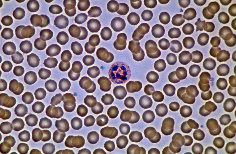 Leukocyte, Drumstick, Phase Contrast Photograph by Michael Abbey