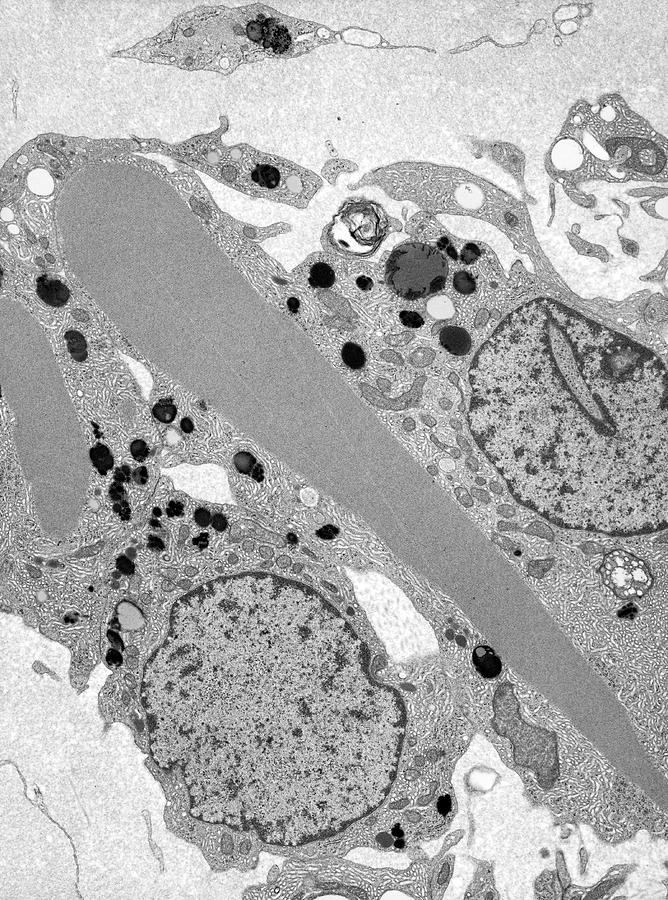 Leydig Cells In Testis Photograph By Microscape Pixels