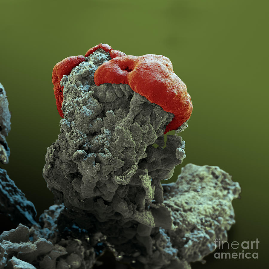 Lichen Sem Photograph by Eye of Science