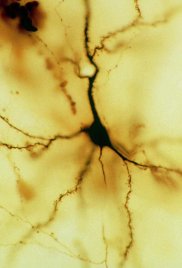 Light Micrograph Of A Pyramidal Neuron Photograph by Douglas & Martin/science Photo Library