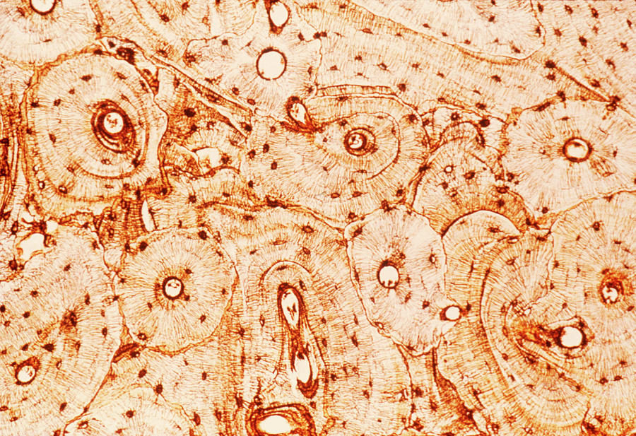 Light Micrograph Of A Section Of Bone Photograph by Gene Cox/science Photo Library
