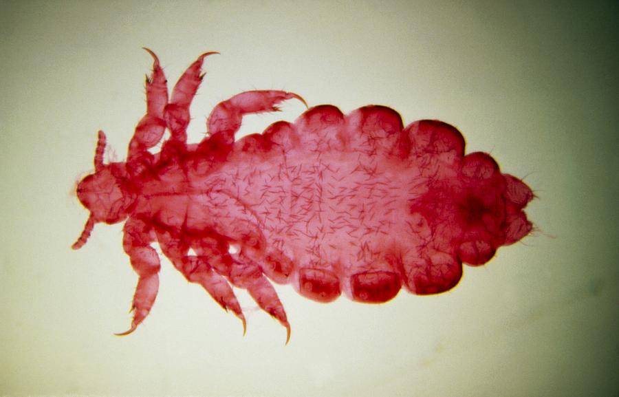 Light micrograph of female of human body louse Photograph by Science Photo Library - ERIC GRAVE.