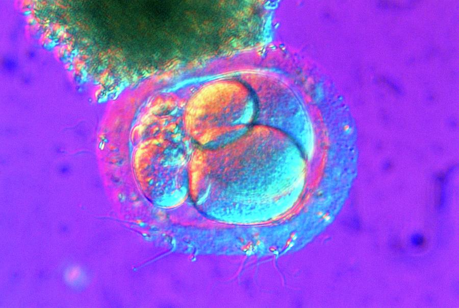 Light Micrograph Of Fertilized Human Egg Cell Photograph by K. H. Kjeldsen/science Photo Library