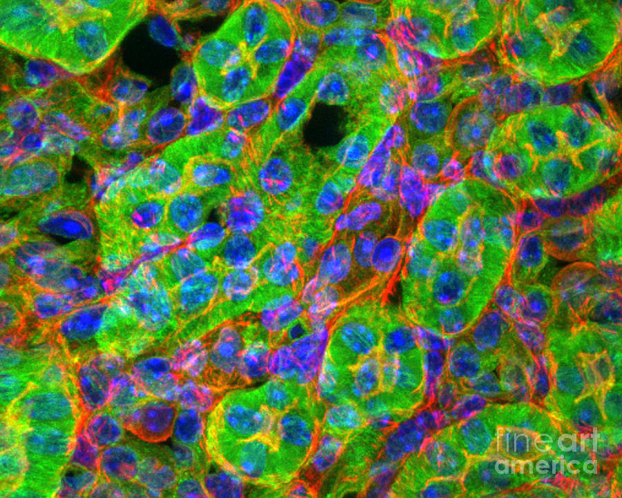 Light Micrograph Of Kidney Tissue Photograph by Lauren Piedmont