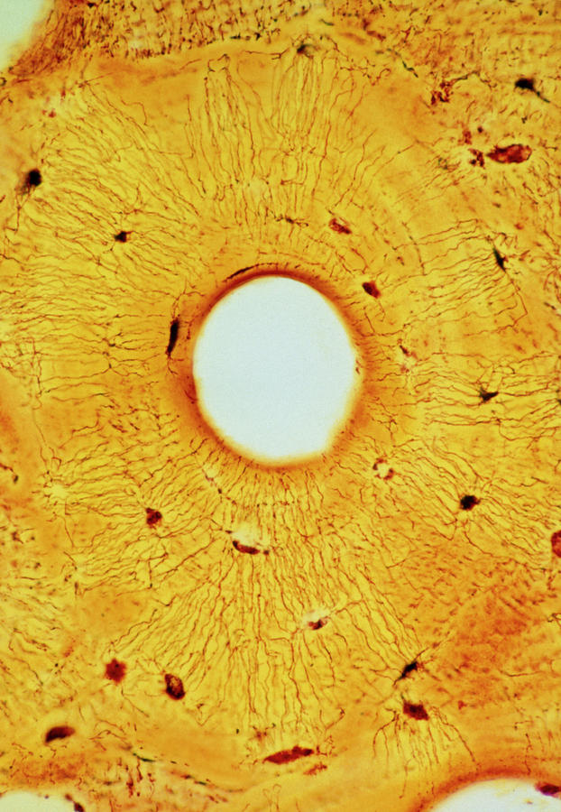 Light Micrograph Of Normal Human Compact Bone Photograph by John Burbidge/science Photo Library