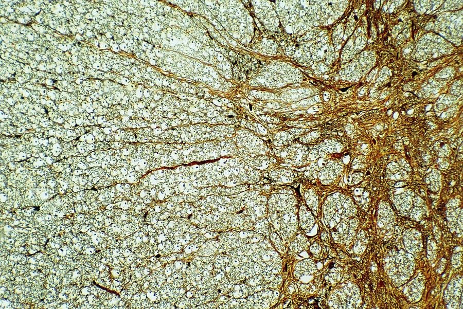 Light Micrograph Of Normal Human Spinal Cord Photograph by Astrid & Hanns-frieder Michler/science Photo Library