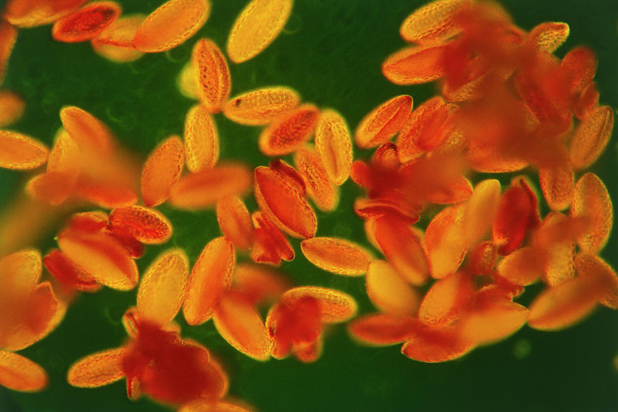 Lily Pollen Grains Photograph by R.b. Taylor/science Photo Library