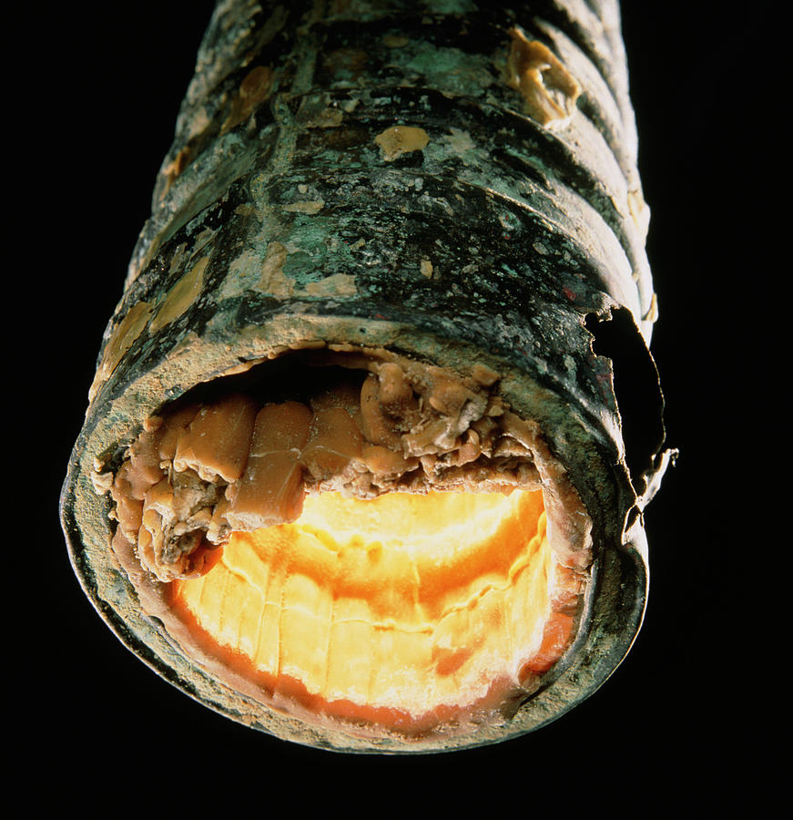 Limescale (calcium Deposit) Inside Metal Pipe Photograph by Sheila Terry/science Photo Library