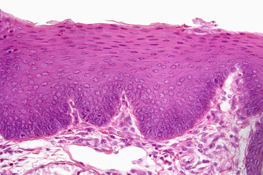 Lingual Salivary Gland, Stratified Photograph by Science Stock ...