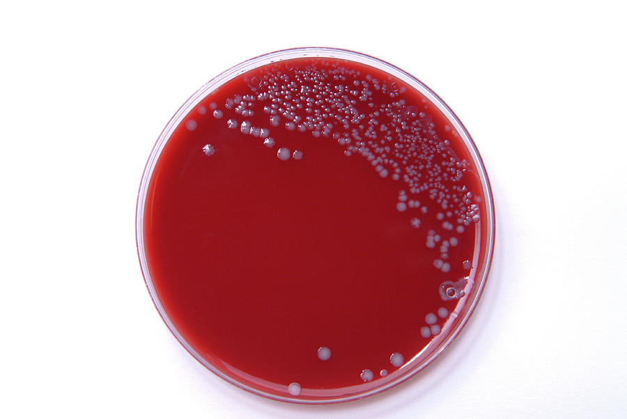 listeria-bacterial-culture-photograph-by-cc-studio-science-photo