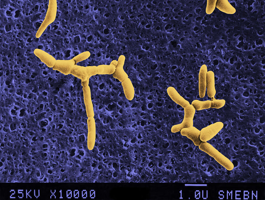 Listeria denitrificans Photograph by Bsip