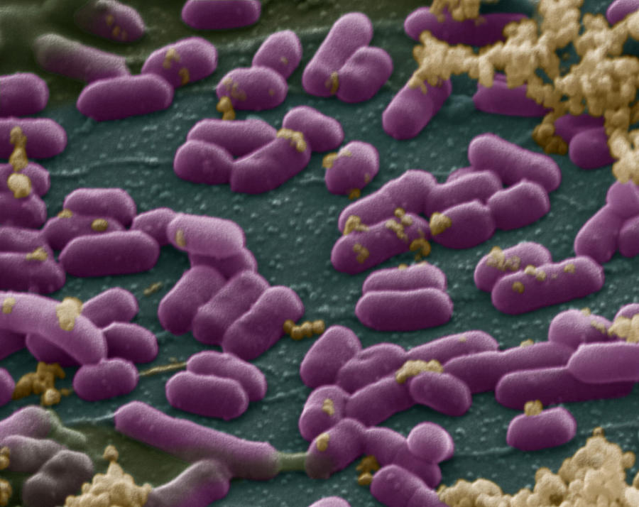 Listeria Monocytogenes Photograph by Eye of Science