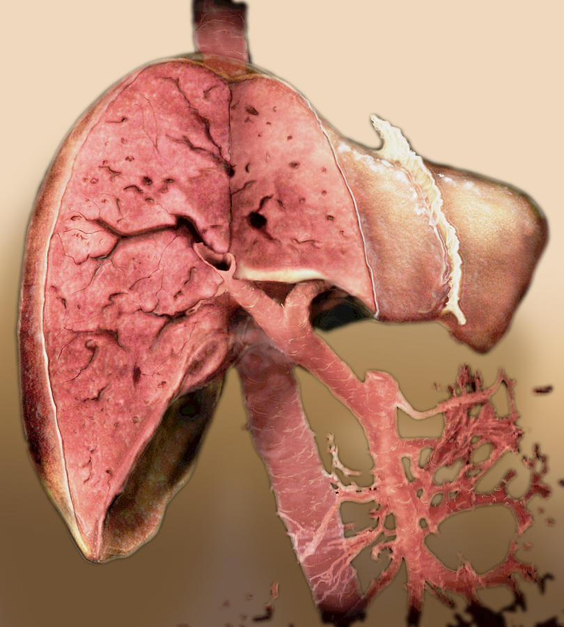 Liver Photograph by Anatomical Travelogue