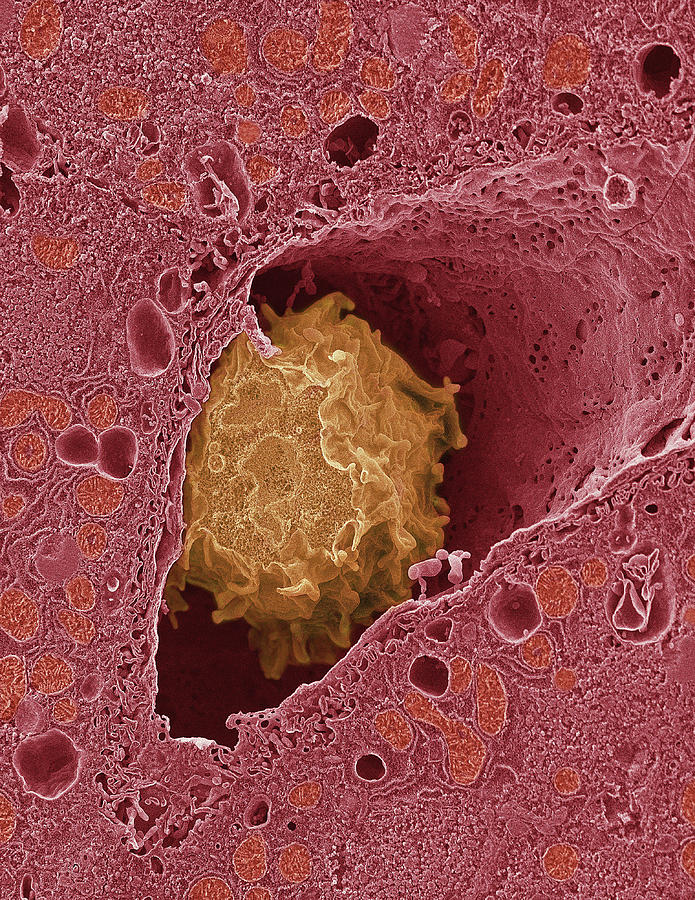 Liver Macrophage Cell Photograph by Thomas Deerinck, Ncmir/science Photo Library