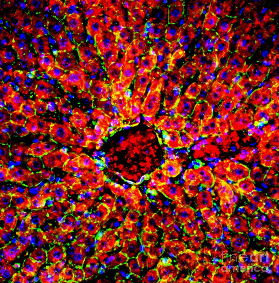 Liver Tissue, Fluorescence Micrograph Photograph by R. Bick, B. Poindexter, Ut Medical School