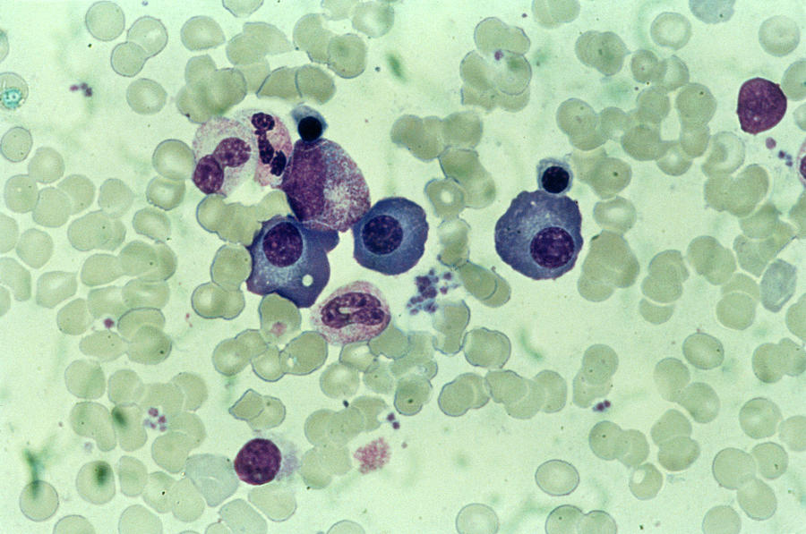 Lm Of A Blood Smear Showing White Blood Cells Photograph by Biophoto ...