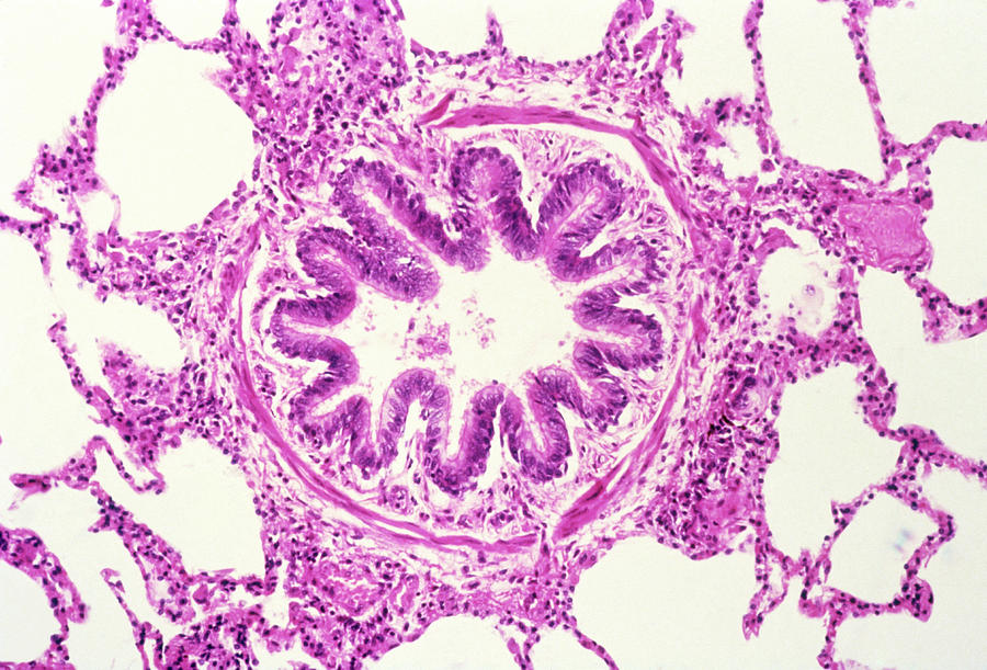 Lm Of A Cross-section Of A Bronchiole & Alveoli Photograph By Biophoto 