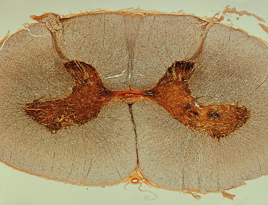 Lm Of A Cross Section Of A Spinal Cord Photograph by Alfred Pasieka/science Photo Library