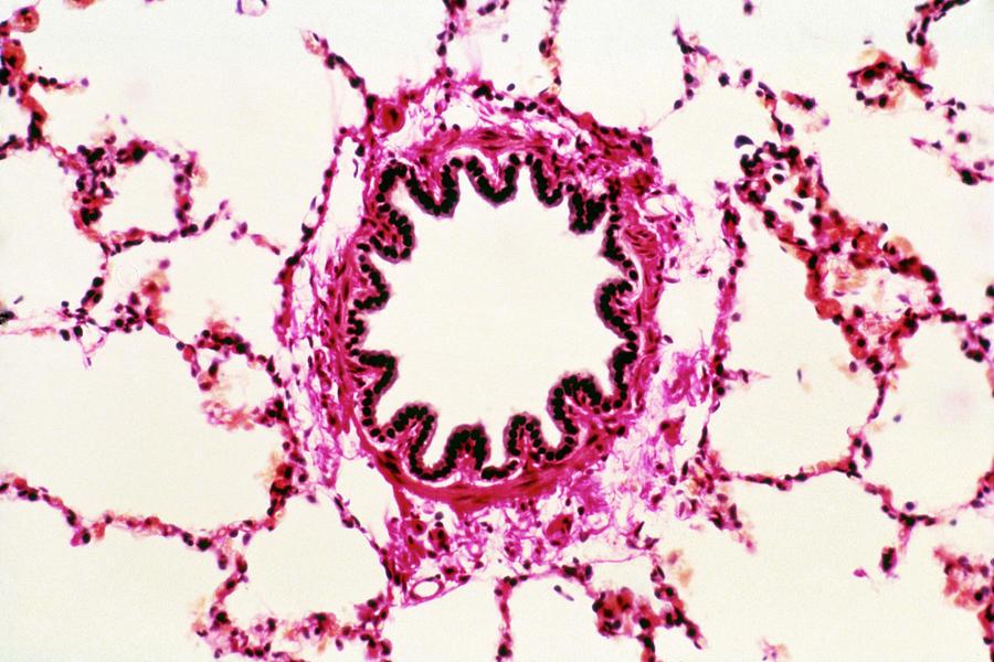 Lm Of A Cross Section Through A Bronchiole In Lung Photograph by ...