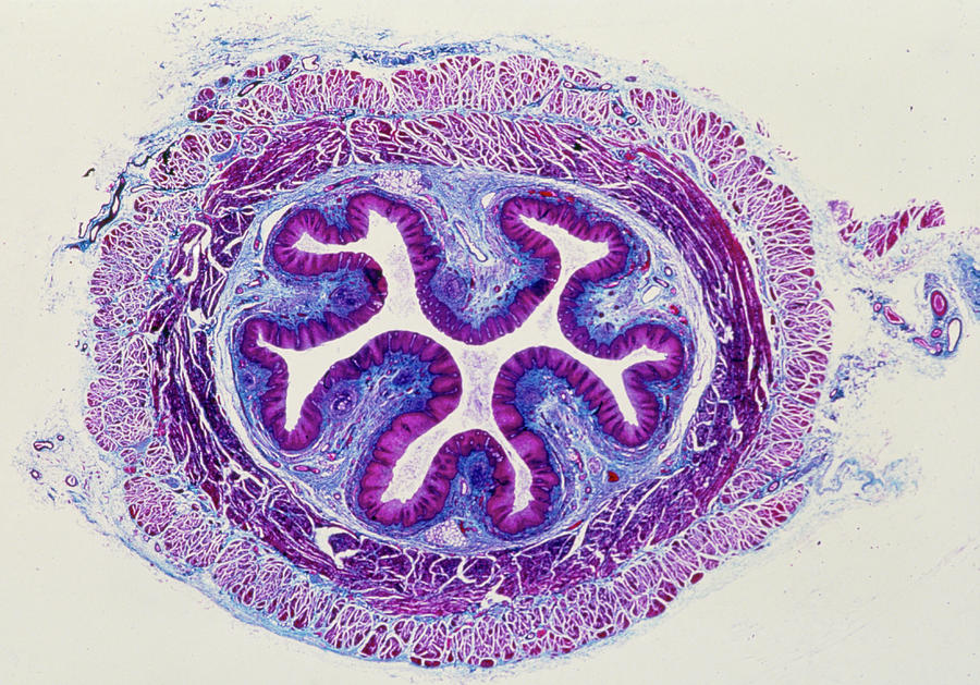Oesophagus Photograph - Lm Of A Cross-section Through The Human Oesophagus by Biophoto Associates/science Photo Library