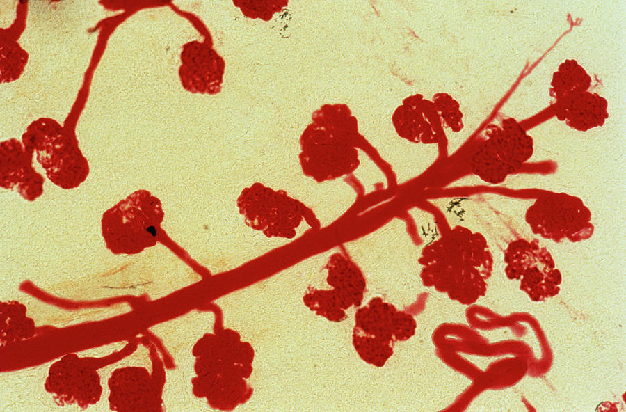Glomerulus Photograph - Lm Of A Section Through A Babys Kidney by John Durham/science Photo Library. Glomerulus Photograph - Lm Of A Section Through A Babys Kidney by John Durham/science Photo Library.