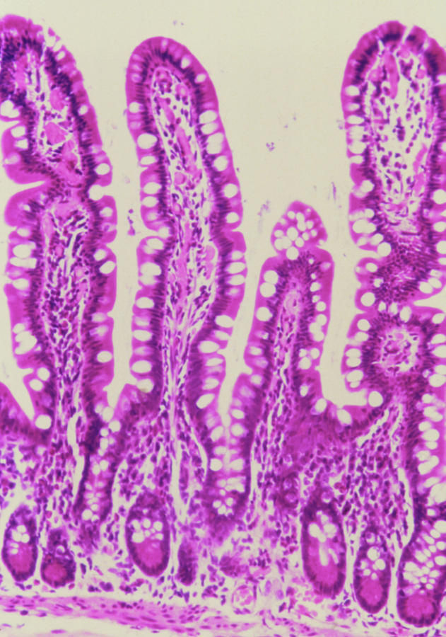 Lm Of A Section Through Intestinal Villi & Crypts Photograph by Biophoto Associates/science Photo Library