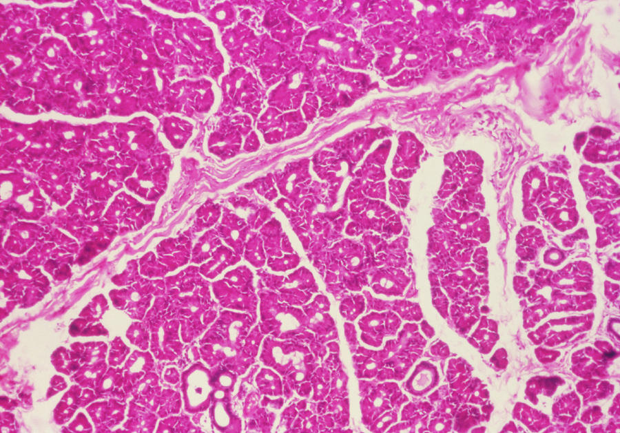 Lm Of A Section Through Lacrimal Gland And Nerve Photograph by Biophoto Associates/science Photo Library