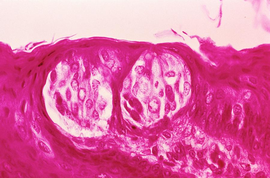 Lm Of A Section Through Taste Buds Photograph by Biophoto Associates/science Photo Library