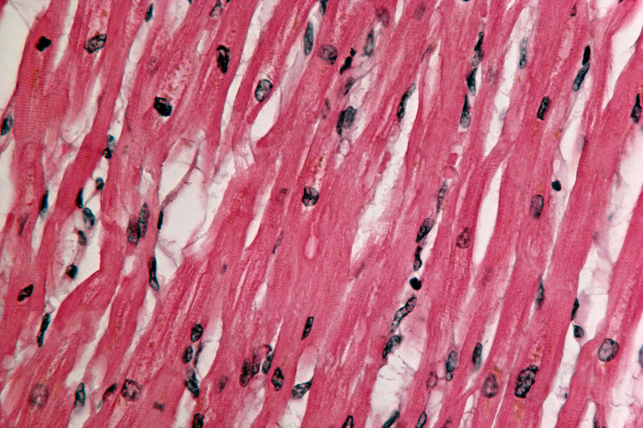 Lm Of Cardiac Muscle Photograph by Michael Abbey