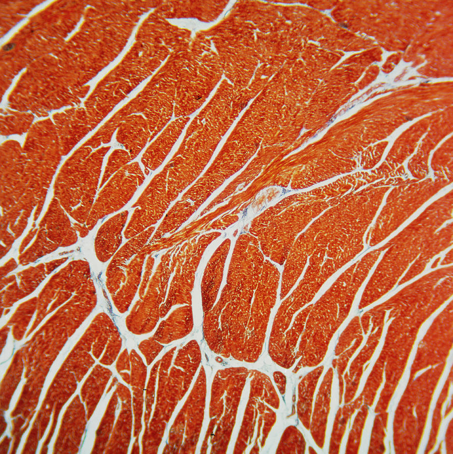Myocardium Photograph - Lm Of Cross Section Of Heart Muscle. by John Burbidge/science Photo Library