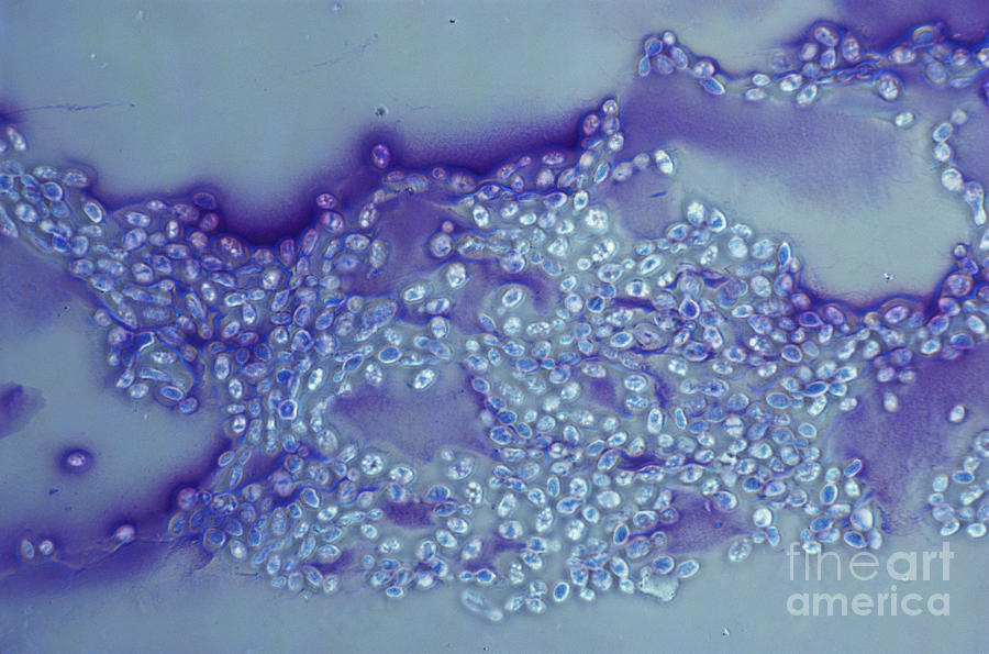 Lm Of Cryptococcus Albidus Photograph by David M. Phillips