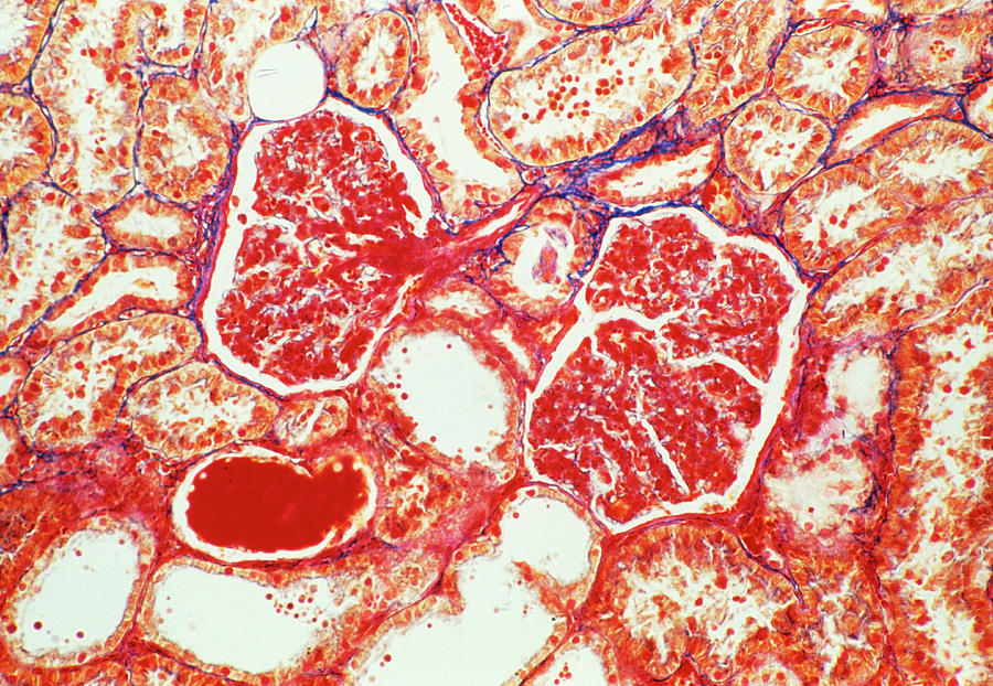 Lm Of Glomerulus And Tubules In A Kidney Section Photograph by Astrid & Hanns-frieder Michler/science Photo Library