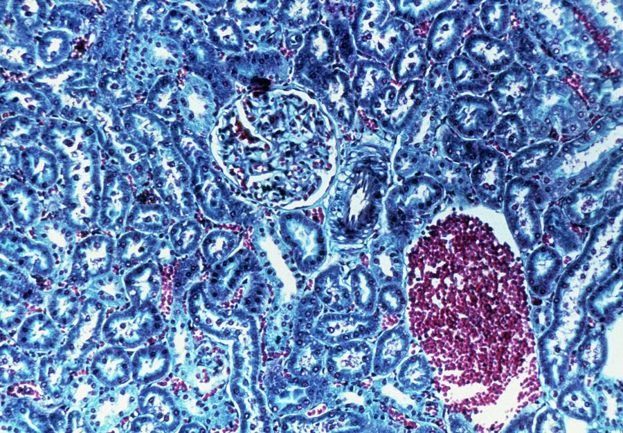 Lm Of Glomerulus And Tubules In A Kidney Section Photograph by Science Pictures Ltd/science Photo Library