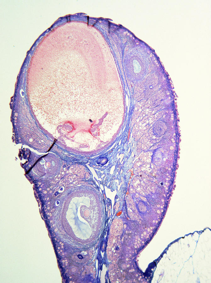 Lm Of Human Ovary Showing A Graafian Follicle. Photograph by John ...