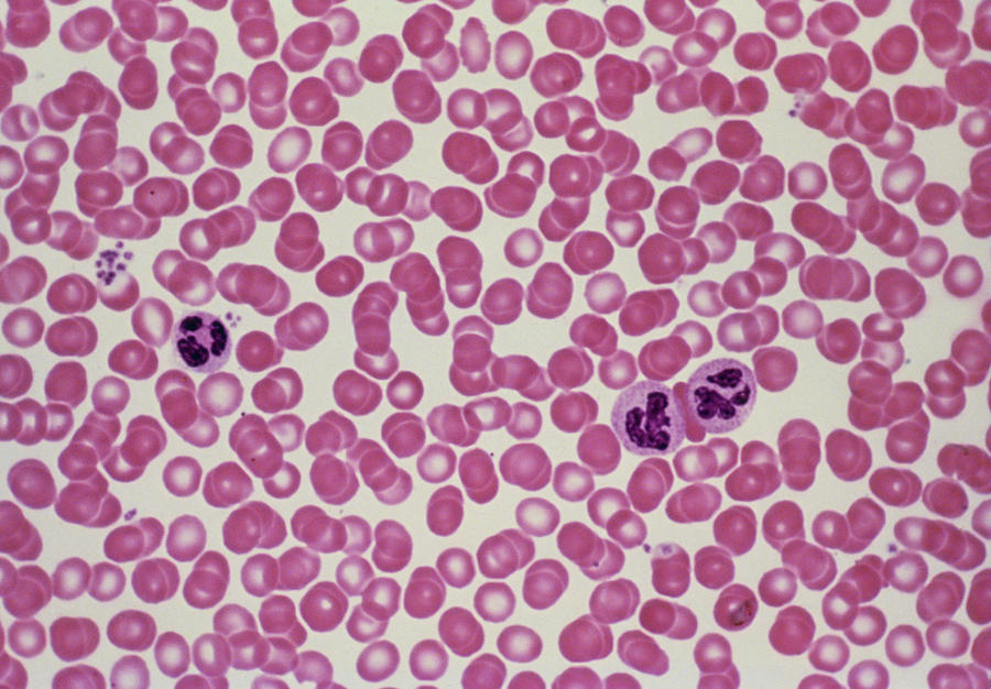 Human White Blood Cells Under Microscope