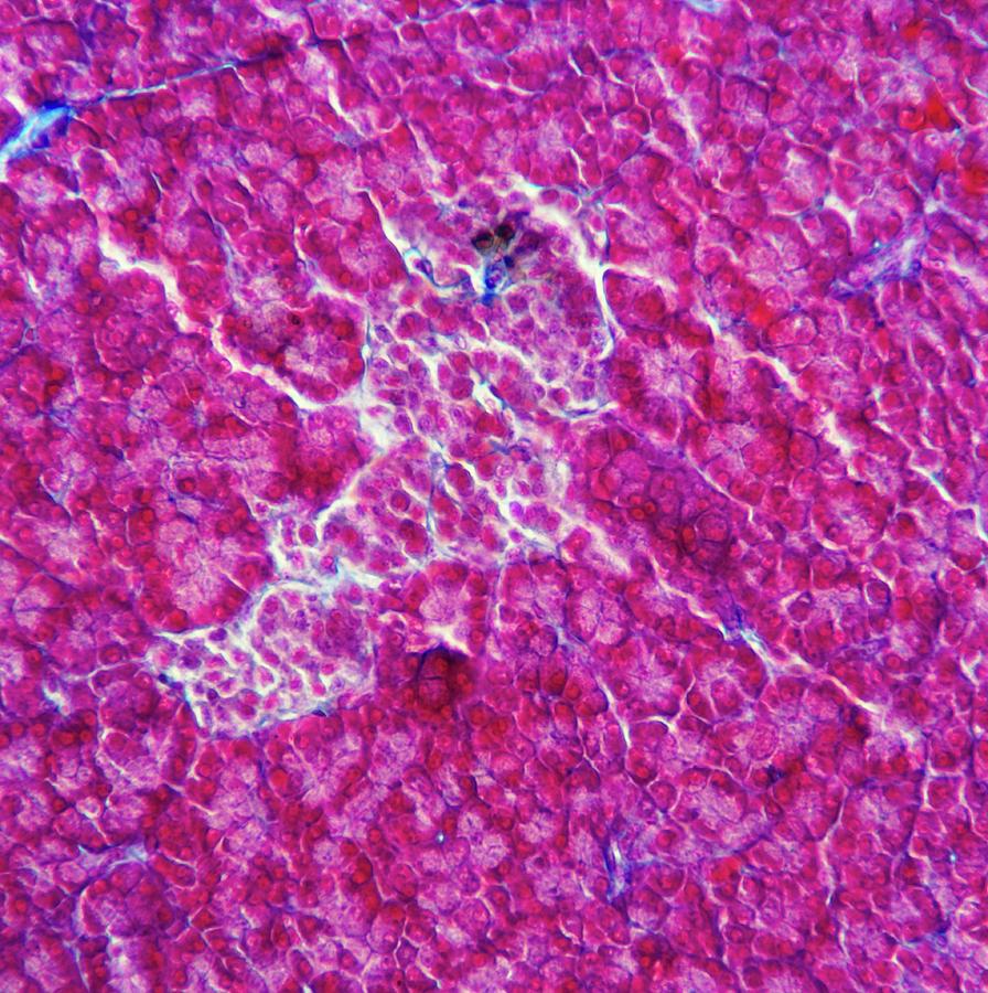 Lm Of Islet Of Langerhans In The Pancreas Photograph by Alfred Pasieka/science Photo Library