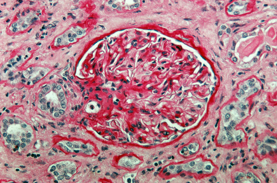 Lm Of Kidney Glomerulus Photograph by Michael Abbey