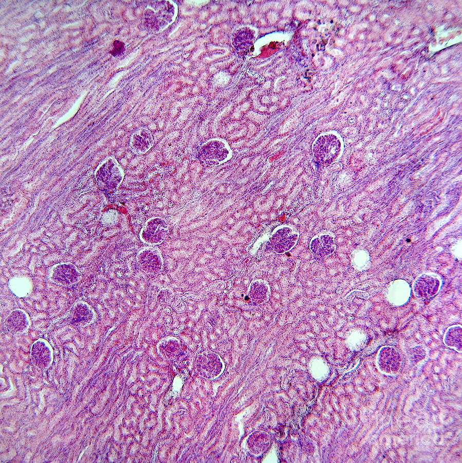 Lm Of Kidney Tissue Photograph by Garry DeLong