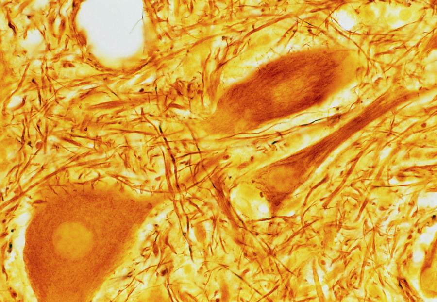 Lm Of Nerve Cells And Fibres In Brain Tissue Photograph by Biophoto Associates/science Photo Library