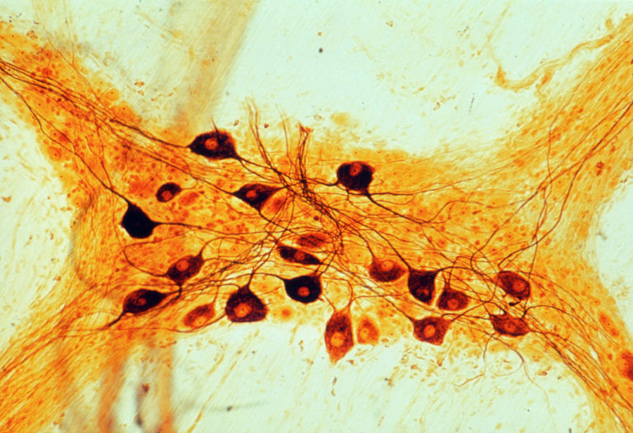 Lm Of Nerve Cells In Autonomic Nervous System Photograph by Biophoto Associates/science Photo Library