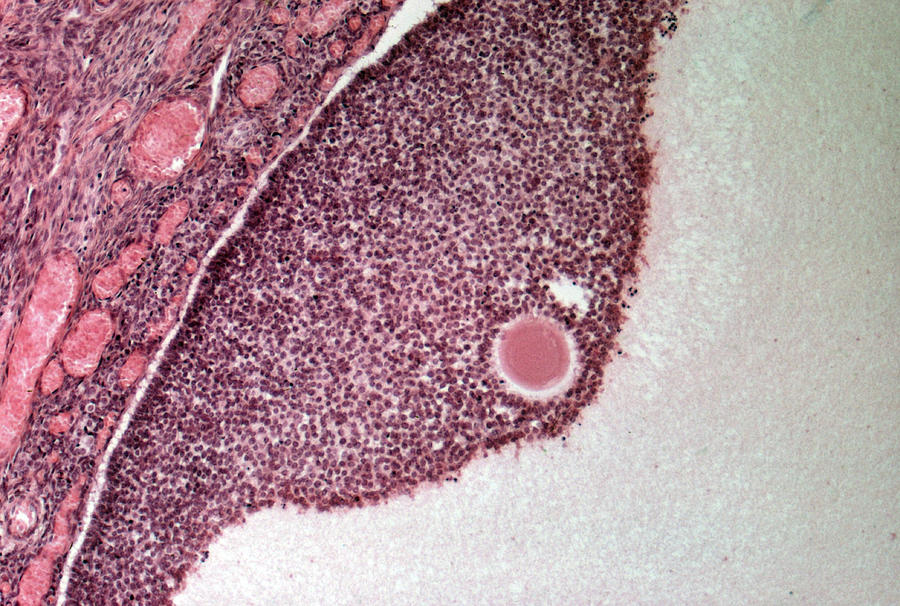Lm Of Ovary With Egg Photograph by Michael Abbey