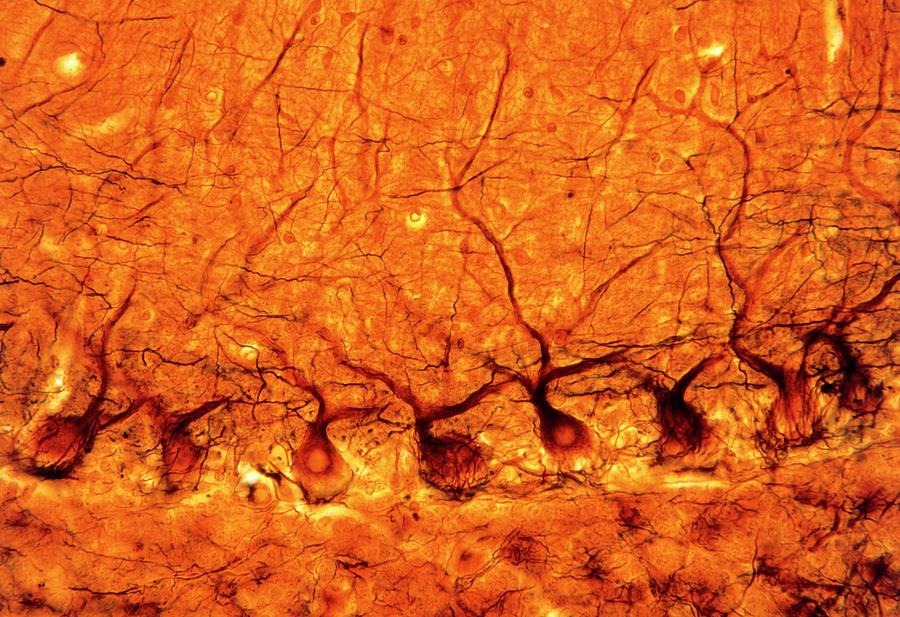 Lm Of Purkinje Nerves Cells In The Cerebe Photograph by Volker Steger