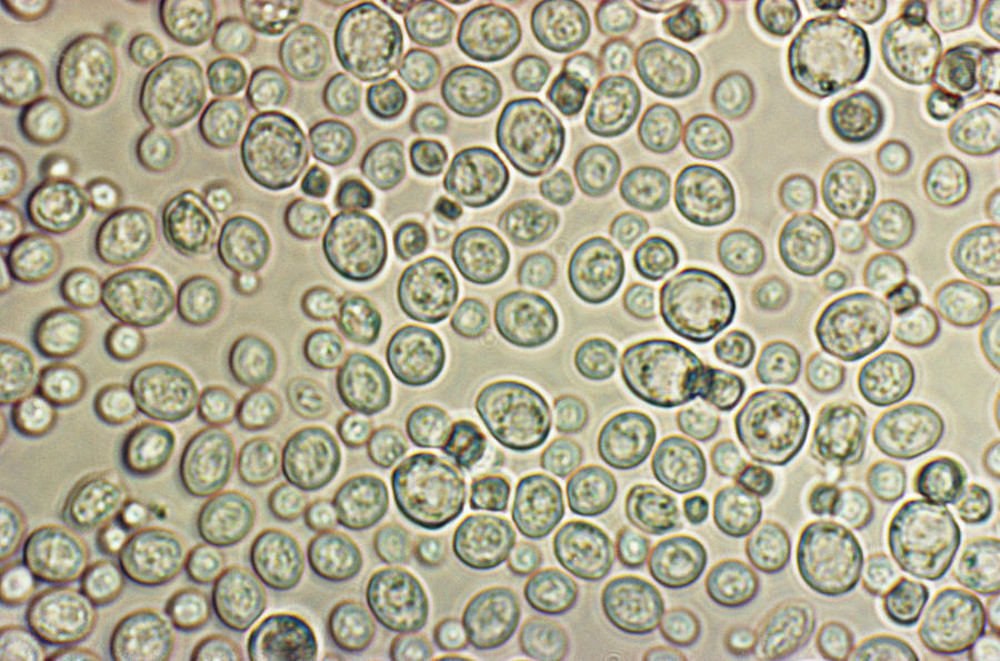 Lm Of Saccharomyces Cerevisiae Photograph by Biology Pics