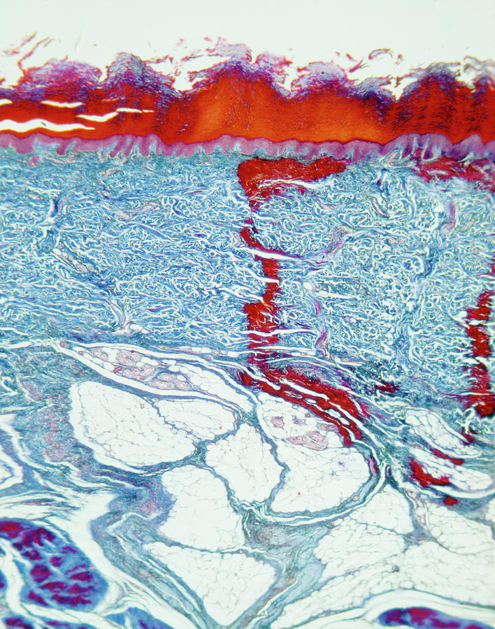 Lm Of Section Of Skin From Palm Of Hand. Photograph by John Burbidge ...